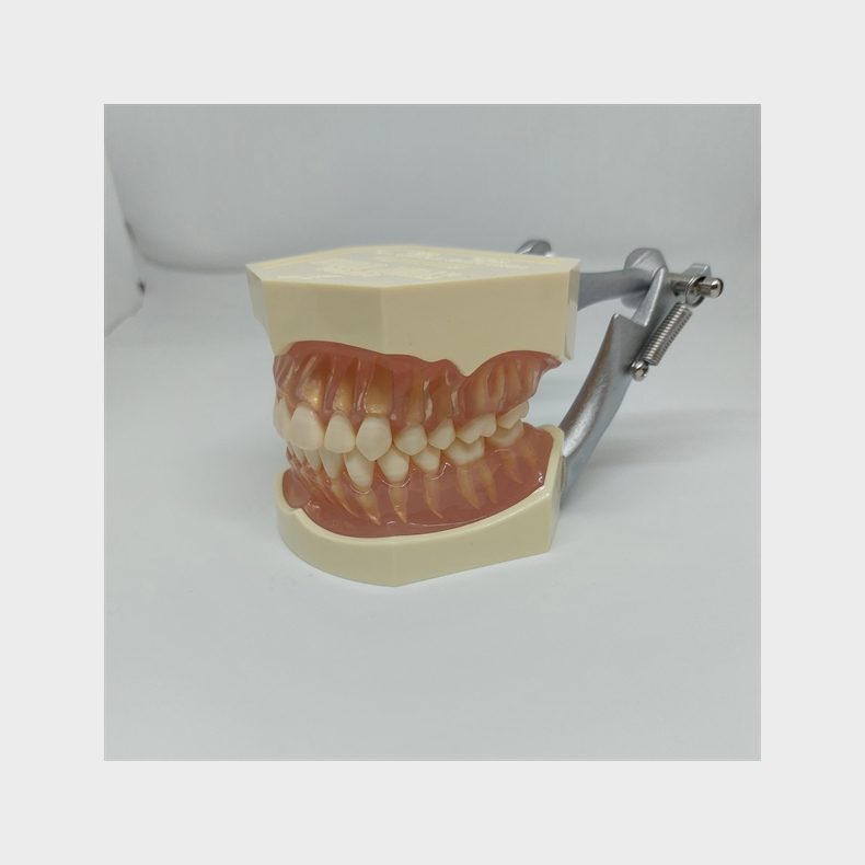 Studiemodel med Aftagelige Tnder 